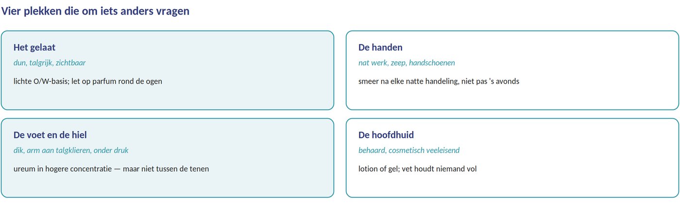 Vier plekken die om iets anders vragen